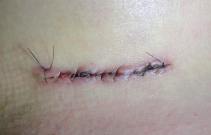 12205088_426593497539589_1089603736_n